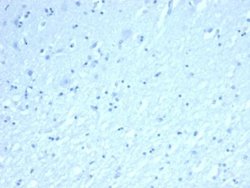 Inhibin alpha Antibody (INHA/6598R) - Azide and BSA Free, Novus Biologicals